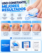 Lámpara Láser De Uñas - Elimina Hongos
